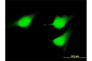Immunofluorescence of monoclonal antibody to MAP2K5 on HeLa cell. (MAP2K5 抗体  (AA 1-120))