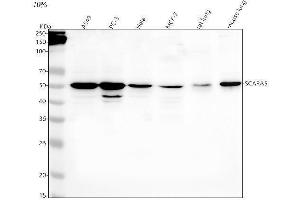 Western blot analysis of SCARA5 using anti-SCARA5 antibody (ABIN7601260).