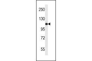 USO1 Antibody (C-term) (ABIN657956 and ABIN2846901) western blot analysis in ZR-75-1 cell line lysates (35 μg/lane). (USO1 抗体  (C-Term))
