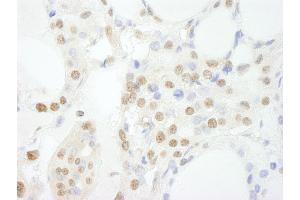 anti-General Transcription Factor 3C Polypeptide 3 (GTF3C3) (AA 475-525) antibody