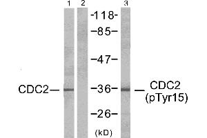 Western blot analysis of extracts from HepG2 cells, CDC2 (Ab-15) antibody (#Line 1 and 2) and CDC2 (phospho-Tyr15) antibody (Line 3). (CDK1 抗体  (pTyr15))