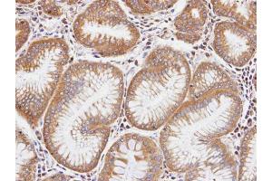 IHC-P Image Immunohistochemical analysis of paraffin-embedded human gastric tissue, using DIAPH1, antibody at 1:100 dilution. (DIAPH1 抗体  (N-Term))