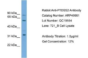 WB Suggested Anti-PTDSS2  Antibody Titration: 0. (PTDSS2 抗体  (Middle Region))