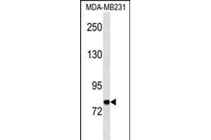 MFI2 Antibody (C-term) (ABIN1537509 and ABIN2850390) western blot analysis in MDA-M cell line lysates (35 μg/lane). (MFI2 抗体  (C-Term))