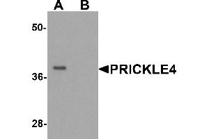 Western Blotting (WB) image for anti-Prickle Homolog 4 (PRICKLE4) (N-Term) antibody (ABIN1077371) (PRICKLE4 抗体  (N-Term))
