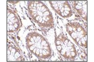 Immunohistochemistry of PTK7 in human colon tissue with this product at 2. (PTK7 抗体  (C-Term))