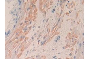Detection of IL8 in Human Prostate Tissue using Monoclonal Antibody to Interleukin 8 (IL8) (IL-8 抗体  (AA 28-99))