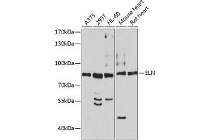 Western blot analysis of extracts of various cell lines, using ELN antibody (ABIN3016530, ABIN3016531, ABIN3016532 and ABIN6219774) at 1:1195 dilution. (Elastin 抗体  (AA 27-200))