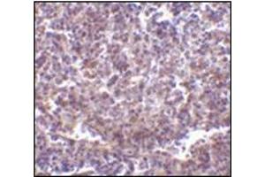 Immunohistochemistry of RP105 in human spleen tissue with this product at 2 μg/ml. (CD180 抗体  (N-Term))