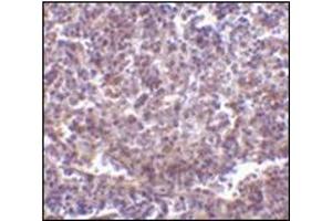 Immunohistochemistry of RP105 in human spleen tissue with this product at 2 μg/ml. (CD180 抗体  (N-Term))