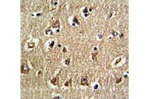 IHC analysis of FFPE human brain tissue stained with RAN antibody (RAN 抗体  (AA 12-39))