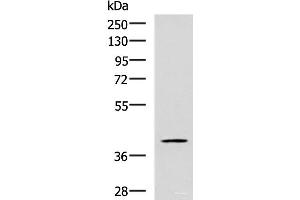 Western blot analysis of TM4 cell lysate using RAB3IL1 Polyclonal Antibody at dilution of 1:600 (RAB3IL1 抗体)