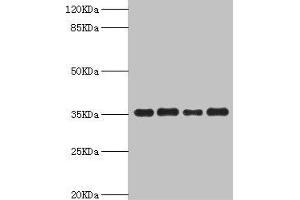 Western blot All lanes: PDXK antibody at 5. (PDXK 抗体  (AA 1-312))