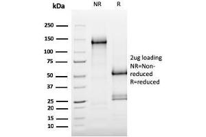 SDS-PAGE Analysis Purified MerTK Mouse Monoclonal Antibody (MERTK/3015). (MERTK 抗体  (AA 55-148))