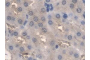 Immunohistochemistry (IHC) image for anti-Pyridoxamine 5'-Phosphate Oxidase (PNPO) (AA 1-261) antibody (ABIN7444253)