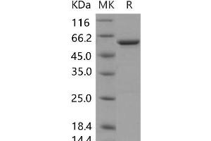 Western Blotting (WB) image for Glutamate Decarboxylase 2 (Pancreatic Islets and Brain, 65kDa) (GAD2) protein (ABIN7195934) (GAD65 蛋白)