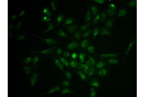 Immunofluorescence analysis of HeLa cell using SELPLG antibody. (SELPLG 抗体)