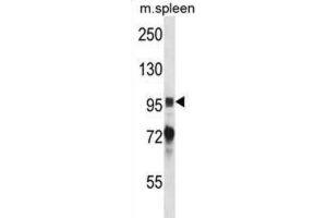 Western Blotting (WB) image for anti-PTK2B Protein tyrosine Kinase 2 beta (PTK2B) antibody (ABIN2997867) (PTK2B 抗体)