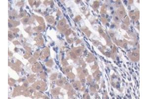 DAB staining on IHC-P; Samples: Human Stomach Tissue (NARS 抗体  (AA 1-330))