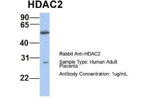 Host:  Rabbit  Target Name:  HDAC2  Sample Type:  Human Adult Placenta  Antibody Dilution:  1. (HDAC2 抗体  (Middle Region))