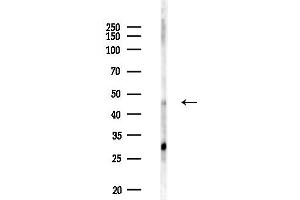 Western blot analysis of lysates from PC12 cells(LPS 4h treatment), using HADHB Antibody at 1/1000 dilution.