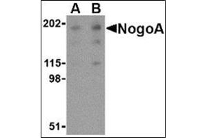 Western blot analysis of NogoA in human brain tissue lysate with this product at (A) 0. (Reticulon 4 抗体  (Isoform 1))