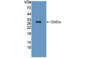 Detection of Recombinant LAG3, Rat using Polyclonal Antibody to Lymphocyte Activation Gene 3 (LAG3) (LAG3 抗体  (AA 209-451))