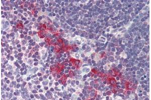 Human Thymus (formalin-fixed, paraffin-embedded) stained with DNASE2 antibody ABIN214485 at 5 ug/ml followed by biotinylated goat anti-rabbit IgG secondary antibody ABIN481713, alkaline phosphatase-streptavidin and chromogen. (DNASE2 抗体  (AA 347-360))