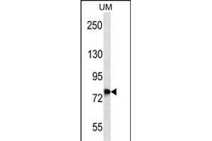 DNAJC14 Antibody (Center) (ABIN657070 and ABIN2846233) western blot analysis in uterus tumor cell line lysates (35 μg/lane). (DNAJC14 抗体  (AA 184-213))