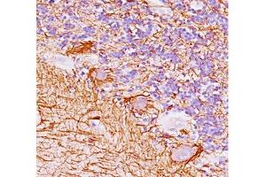 Human cerebellum stained with Neurofilament antibody (NF421). (Neurofilament 抗体)
