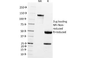 SDS-PAGE (SDS) image for anti-Ubiquitin Carboxyl-terminal Esterase L1 (Ubiquitin Thiolesterase) (UCHL1) antibody (ABIN6940854)