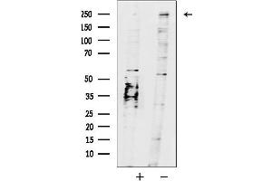 anti-K(lysine) Acetyltransferase 6B (KAT6B) (C-Term) antibody