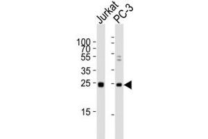 Western blot analysis of lysate from human Jurkat and rat PC-3 lysate using HMGB4 antibody diluted at 1:1000. (HMGB4 抗体  (AA 45-73))