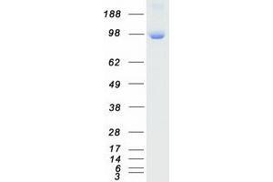 Validation with Western Blot (PKD2 Protein (Transcript Variant 1) (Myc-DYKDDDDK Tag))