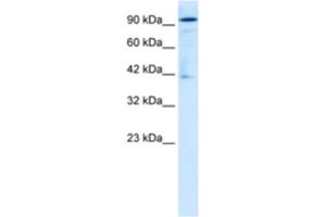 Western Blotting (WB) image for anti-OTU Domain Containing 7B (OTUD7B) antibody (ABIN2460998) (OTUD7B 抗体)