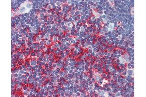 Immunohistochemistry (IHC) image for anti-Actin, beta (ACTB) (AA 359-368) antibody (ABIN574006)