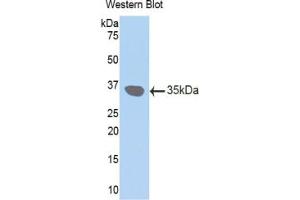 Western blot analysis of the recombinant protein. (Connexin 31 抗体  (AA 210-270))