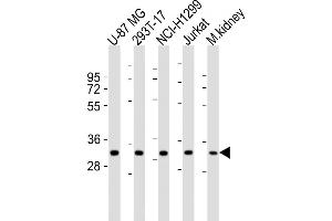 All lanes : Anti-FN3KRP Antibody (N-Term) at 1:1000-1:2000 dilution Lane 1: U-87 MG whole cell lysates Lane 2: 293T-17 whole cell lysates Lane 3: NCI- whole cell lysates Lane 4: Jurkat whole cell lysates Lane 5: mouse kidney lysates Lysates/proteins at 20 μg per lane. (FN3KRP 抗体  (AA 24-58))
