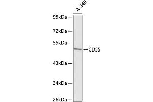 Western blot analysis of extracts of A-549 cells, using CD55 antibody (ABIN6130080, ABIN6138206, ABIN6138207 and ABIN6218089) at 1:1000 dilution. (CD55 抗体  (AA 40-300))