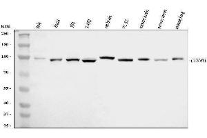 Western blot analysis of Delta 1 Catenin/CAS/CTNND1 using anti-Delta 1 Catenin/CAS/CTNND1 antibody (ABIN7601281).