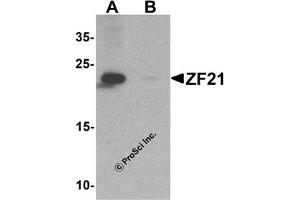 Western Blotting (WB) image for anti-Zinc Finger, FYVE Domain Containing 21 (ZFYVE21) (N-Term) antibody (ABIN1031675)