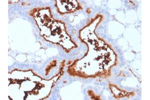Immunohistochemistry (IHC) image for anti-5'-Nucleotidase, Ecto (CD73) (NT5E) antibody (ABIN6940227)