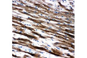 Anti-AIF antibody, IHC(P) IHC(P): Rat Cardiac Muscle Tissue