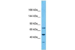 Host:  Rabbit  Target Name:  PKD2  Sample Type:  Stomach Tumor lysates  Antibody Dilution:  1. (PKD2 抗体  (N-Term))