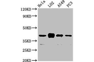 Western Blot Positive WB detected in: Hela whole cell lysate, LO2 whole cell lysate, A549 whole cell lysate, PC-3 whole cell lysate All lanes: VN1R1 antibody at 3. (VN1R1 抗体  (AA 1-56))
