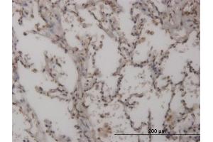 Immunoperoxidase of monoclonal antibody to FOXL1 on formalin-fixed paraffin-embedded human lung. (FOXL1 抗体  (AA 132-240))