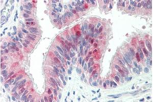 ABIN335141 (5µg/ml) staining of paraffin embedded Human Lung. (ZDHHC13 抗体  (C-Term))