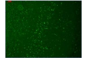 Immunofluorescence (IF) image for anti-Transient Receptor Potential Cation Channel, Subfamily M, Member 7 (TRPM7) (AA 1817-1863), (C-Term) antibody (ABIN452417) (TRPM7 抗体  (C-Term))