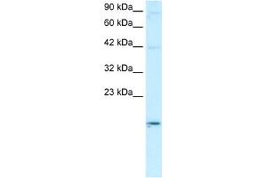 WB Suggested Anti-APOBEC3G Antibody Titration:  0. (APOBEC3G 抗体  (N-Term))