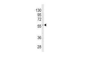 Western blot analysis of CYP4B1 Antibody (Center) (ABIN652592 and ABIN2842397) in MDA-M cell line lysates (35 μg/lane). (CYP4B1 抗体  (AA 331-362))